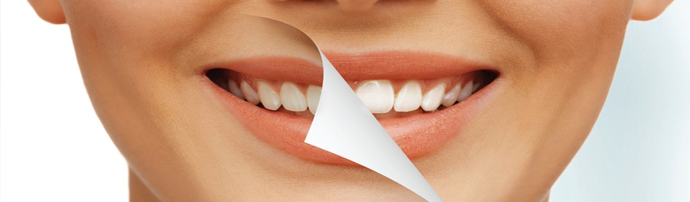 Cosmetic Dentistry